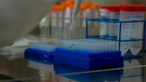 Fisabio i la Universitat Jaume I de Castelló cerquen col·laboració per a investigar la síndrome de Smith-Lemli-Opitz (SLOS) Fisabio i la Universitat Jaume I de Castelló cerquen col·laboració per a investigar la síndrome de Smith-Lemli-Opitz (SLOS)