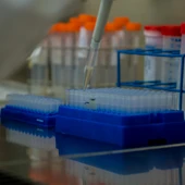 Fisabio i la Universitat Jaume I de Castelló cerquen col·laboració per a investigar la síndrome de Smith-Lemli-Opitz (SLOS) Fisabio i la Universitat Jaume I de Castelló cerquen col·laboració per a investigar la síndrome de Smith-Lemli-Opitz (SLOS)