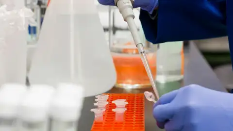 Las muestras liofilizadas de trasplantan al receptor Las muestras liofilizadas de trasplantan al receptor