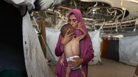 Un niño gazatí de 18 meses, de cuerpo esquelético, en brazos de su madre en una imagen del 26 de julio de 2025. La ONU declara oficialmente la hambruna en la ciudad de Gaza y alrededores