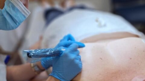 El servicio de micropigmentaci&oacute;n mamaria en el Hospital Vega Baja ayuda al paciente en su proceso de recuperaci&oacute;n f&iacute;sica y psicol&oacute;gica