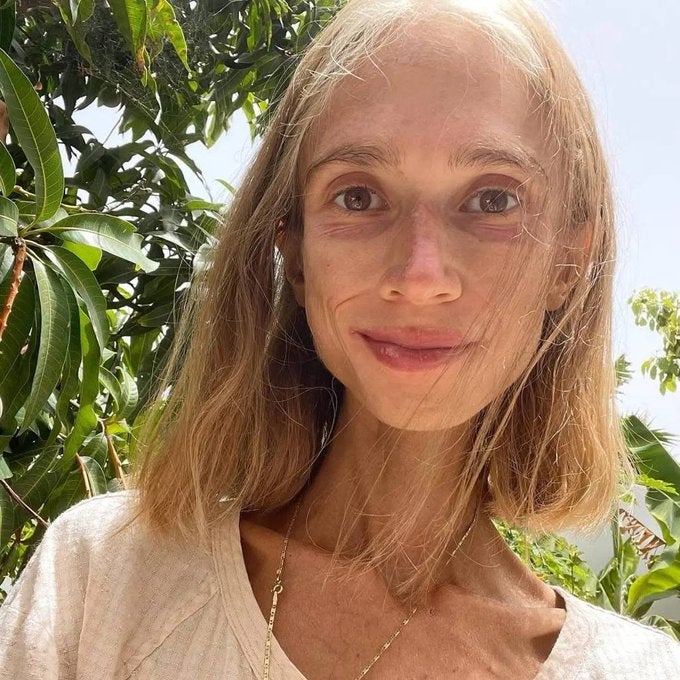 Quién era Karolina Krzyzak, la influencer que ha muerto en Bali: pesaba 22 kilos y solo comía fruta Quién era Karolina Krzyzak, la influencer que ha muerto en Bali: pesaba 22 kilos y solo comía fruta