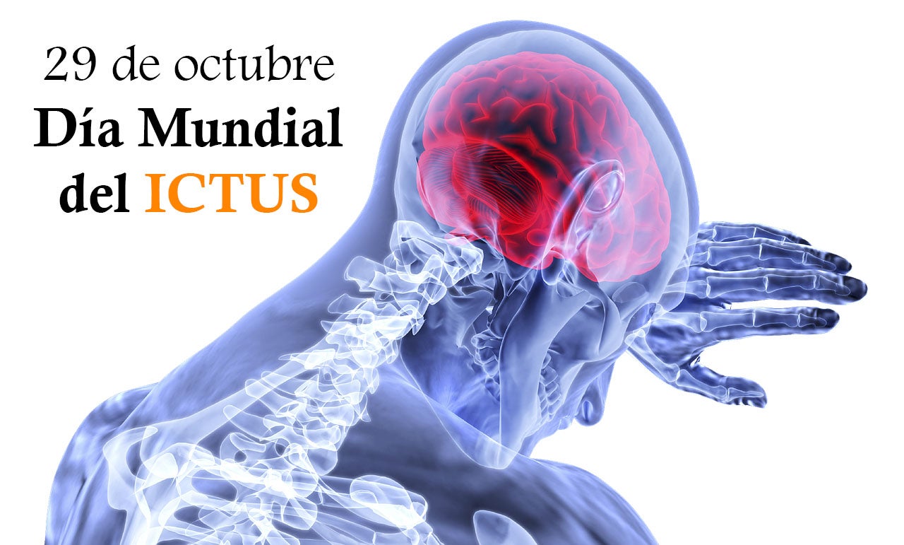 Asturias tendrá un servicio permanente de atención neurológica por ictus Asturias tendrá un servicio permanente de atención neurológica por ictus