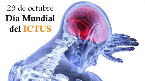 La SEN recuerda que uno de cada cuatro españoles padecerá un ictus en su vida Día Mundial del ICTUS