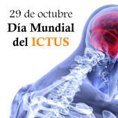 La SEN recuerda que uno de cada cuatro españoles padecerá un ictus en su vida