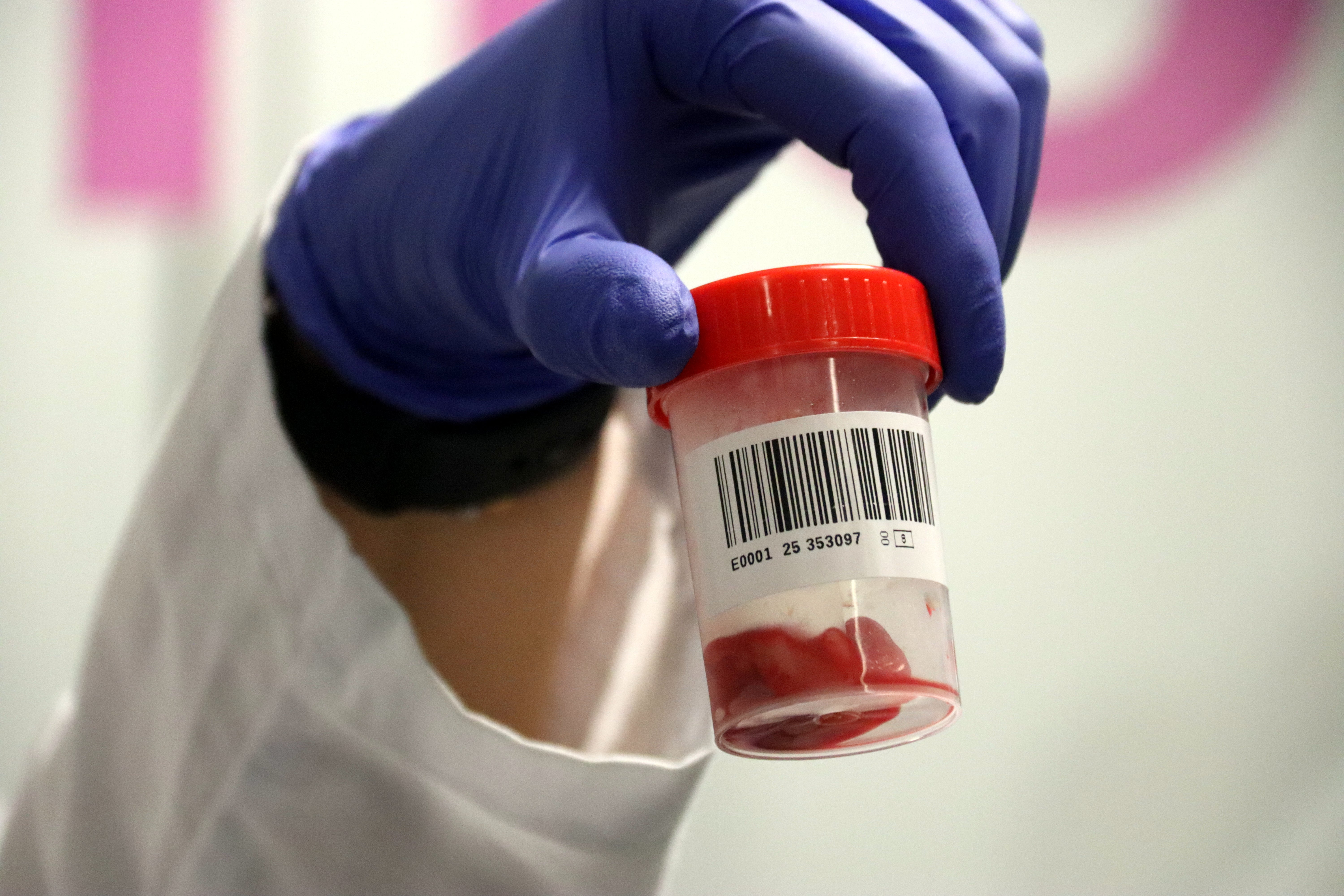 El banc de cordó umbilical vol revertir la caiguda de donacions amb una nova tècnica El banc de cordó umbilical vol revertir la caiguda de donacions amb una nova tècnica