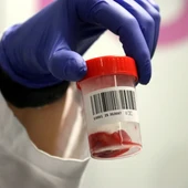 El banc de cordó umbilical vol revertir la caiguda de donacions amb una nova tècnica El banc de cordó umbilical vol revertir la caiguda de donacions amb una nova tècnica