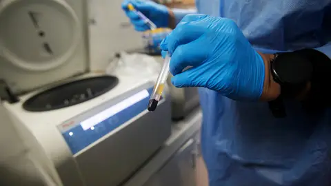 Un sanitario manipula una muestra para un examen de VIH. Un sanitario manipula una muestra para un examen de VIH.