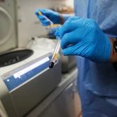 Un sanitario manipula una muestra para un examen de VIH. Un sanitario manipula una muestra para un examen de VIH.