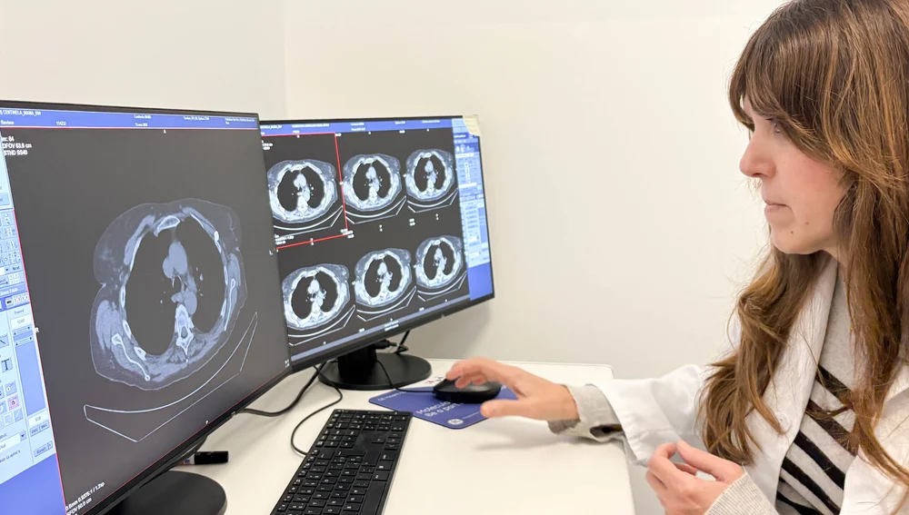 el SPECT-CT se suma así al PET-TC como una de las grandes herramientas de la medicina nuclear moderna siendo ambas técnicas complementarias el SPECT-CT se suma así al PET-TC como una de las grandes herramientas de la medicina nuclear moderna siendo ambas técnicas complementarias