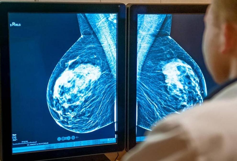 Así lucha contra el cáncer una inmigrante irregular en Zaragoza Así lucha contra el cáncer una inmigrante irregular en Zaragoza