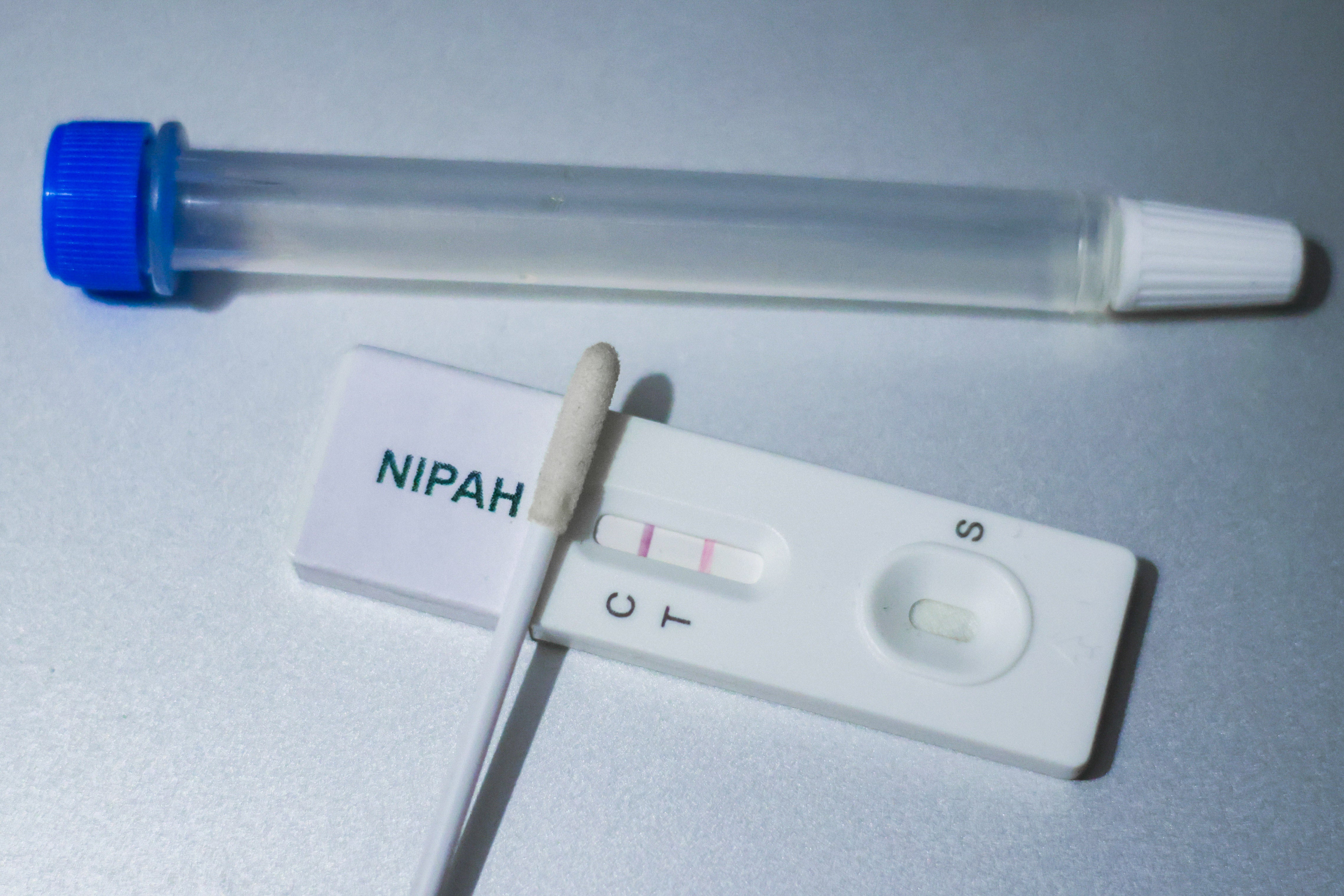 Claves que debemos conocer sobre el peligroso virus Nipah Claves que debemos conocer sobre el peligroso virus Nipah