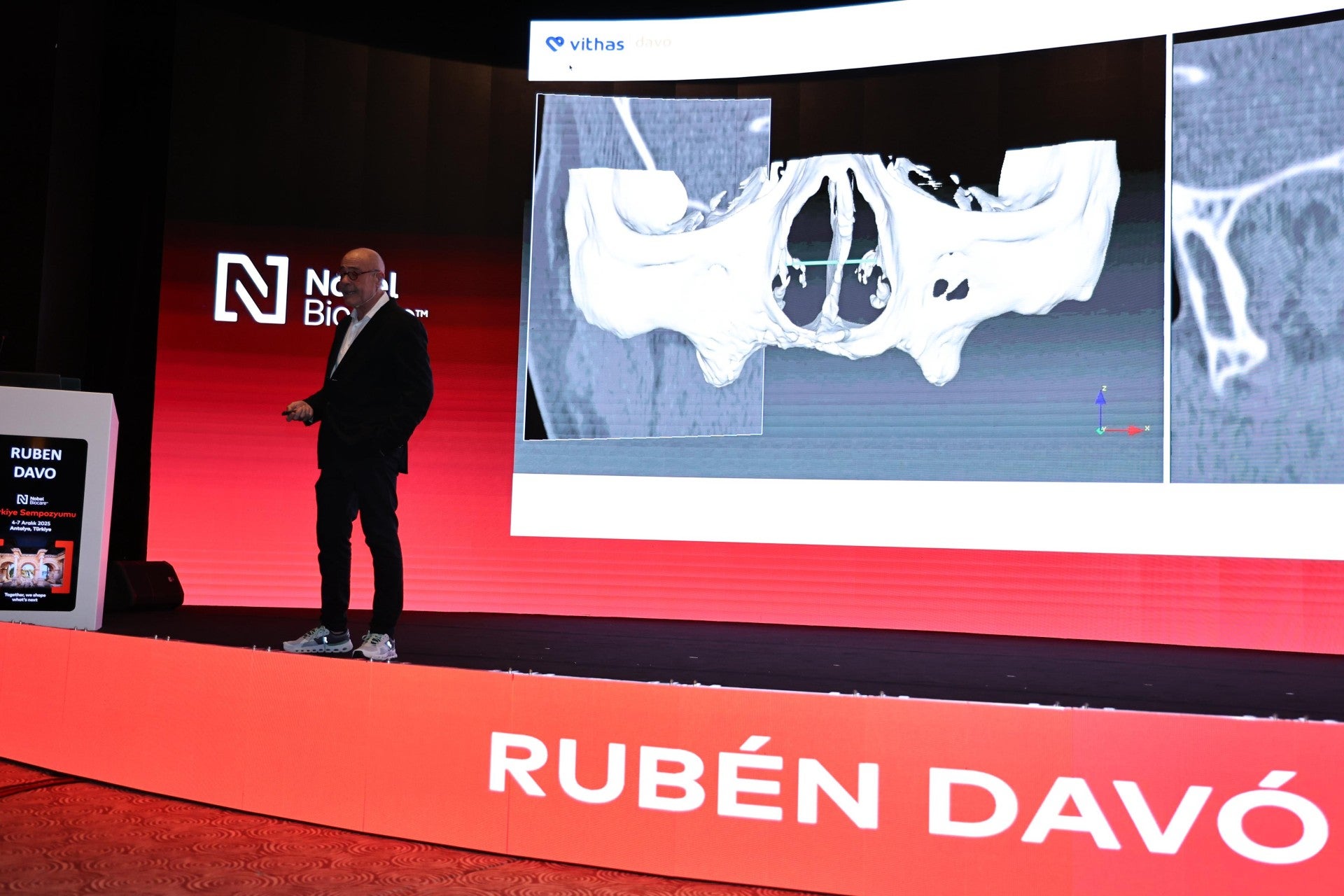 Un estudio internacional coliderado por el Dr. Rubén Davó, de Vithas Medimar, valida el uso de la IA en la planificación de cirugía de implantes cigomáticos Un estudio internacional coliderado por el Dr. Rubén Davó, de Vithas Medimar, valida el uso de la IA en la planificación de cirugía de implantes cigomáticos