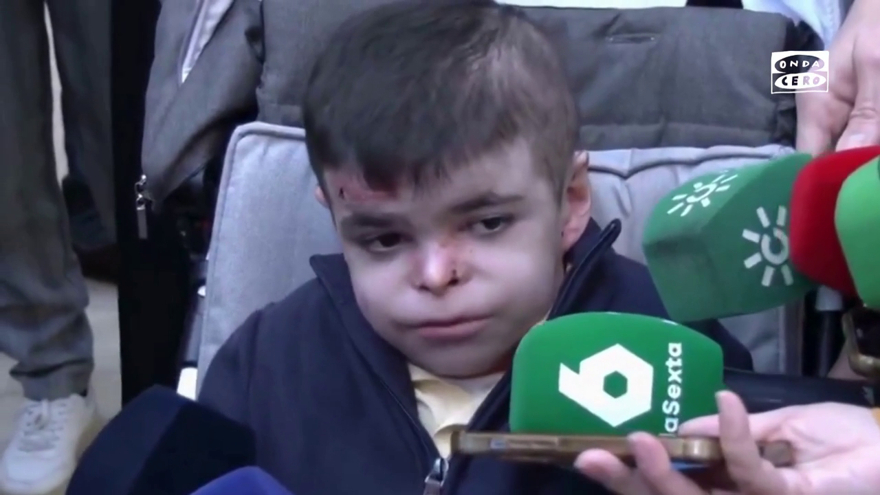 Leo, el niño con piel de mariposa, logra que la Junta de Andalucía asuma el coste del tratamiento Leo, el niño con piel de mariposa, logra que la Junta de Andalucía asuma el coste del tratamiento