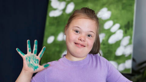 Una niña con síndrome de Down Una niña con síndrome de Down