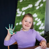 Una niña con síndrome de Down Una niña con síndrome de Down