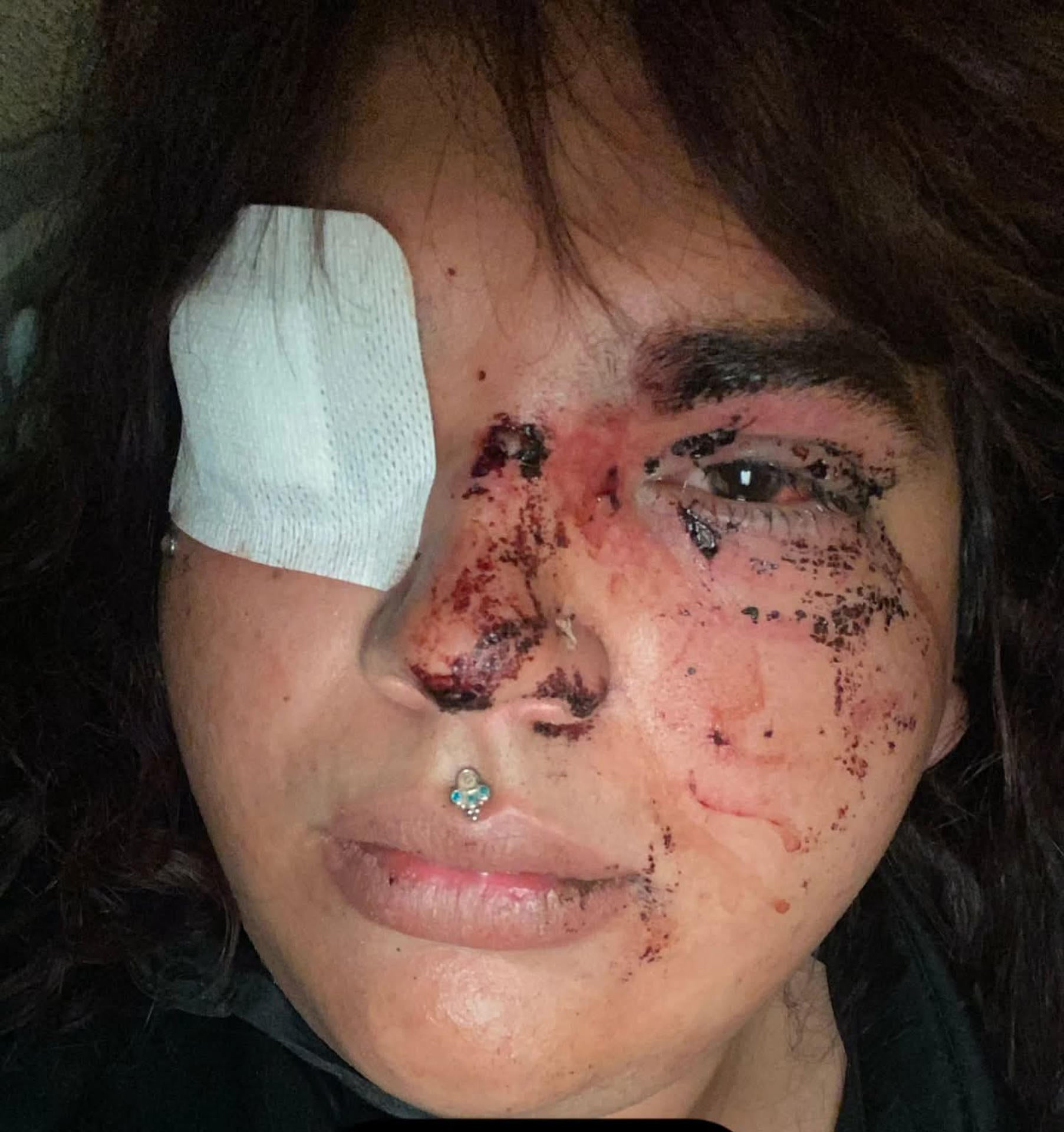 Detenidas cinco mujeres por la brutal paliza a Miss Trans Zamora en La Bañeza, León Detenidas cinco mujeres por la brutal paliza a Miss Trans Zamora en La Bañeza, León
