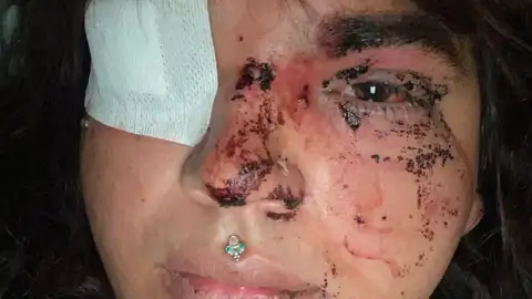 Miss Trans Zamora recibe una paliza en La Bañeza, León. Miss Trans Zamora recibe una paliza en La Bañeza, León.