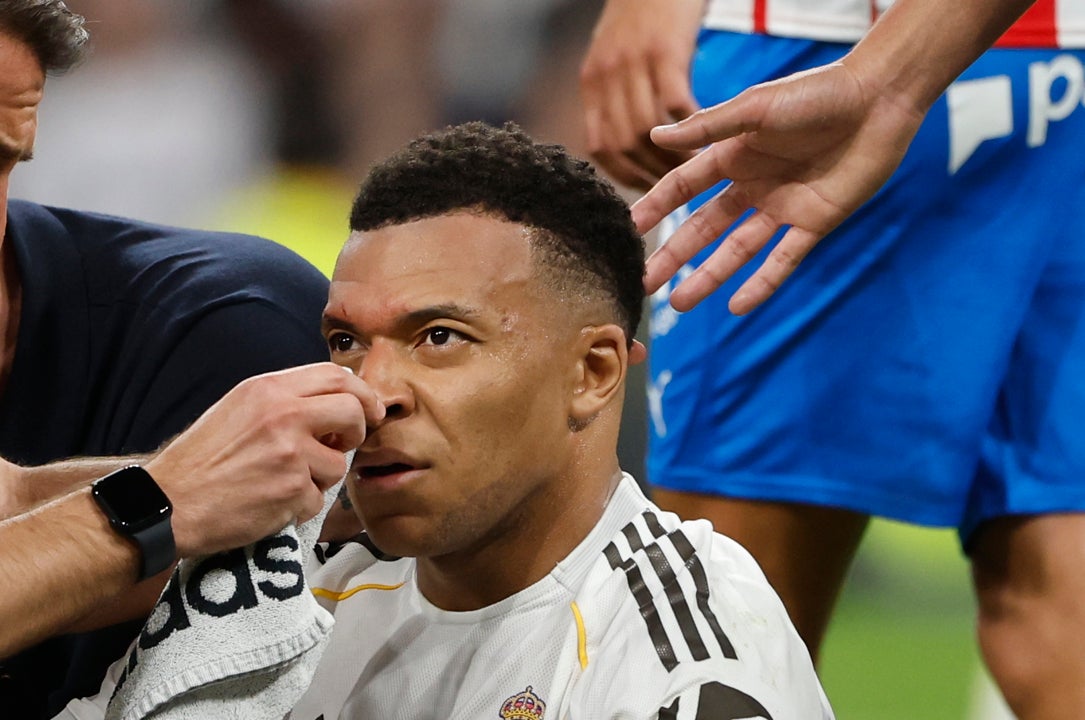 Mbappé regresa a los entrenamientos con un apósito en la ceja Mbappé regresa a los entrenamientos con un apósito en la ceja
