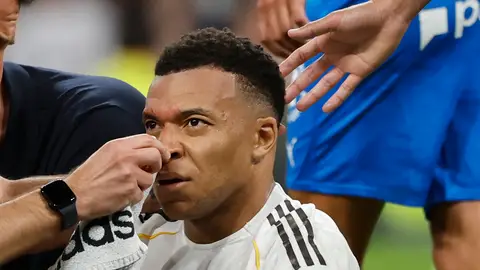Mbappé regresa a los entrenamientos con un apósito en la ceja Mbappé regresa a los entrenamientos con un apósito en la ceja