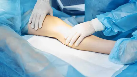 Una intervención de rodilla Una intervención de rodilla