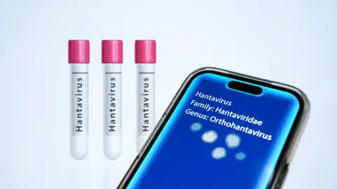 La OMS aclara cómo se transmite el hantavirus y qué se entiende por contacto estrecho: "Estar prácticamente cara a cara" La OMS aclara cómo se transmite el hantavirus y qué se entiende por contacto estrecho: "Estar prácticamente cara a cara"