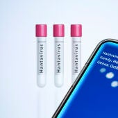 La OMS aclara cómo se transmite el hantavirus y qué se entiende por contacto estrecho: "Estar prácticamente cara a cara"