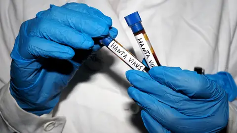 Fotografía ilustrativa de un científico con dos tubos de laboratorio de hantavirus. Fotografía ilustrativa de un científico con dos tubos de laboratorio de hantavirus.
