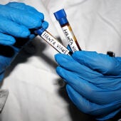 Fotografía ilustrativa de un científico con dos tubos de laboratorio de hantavirus.