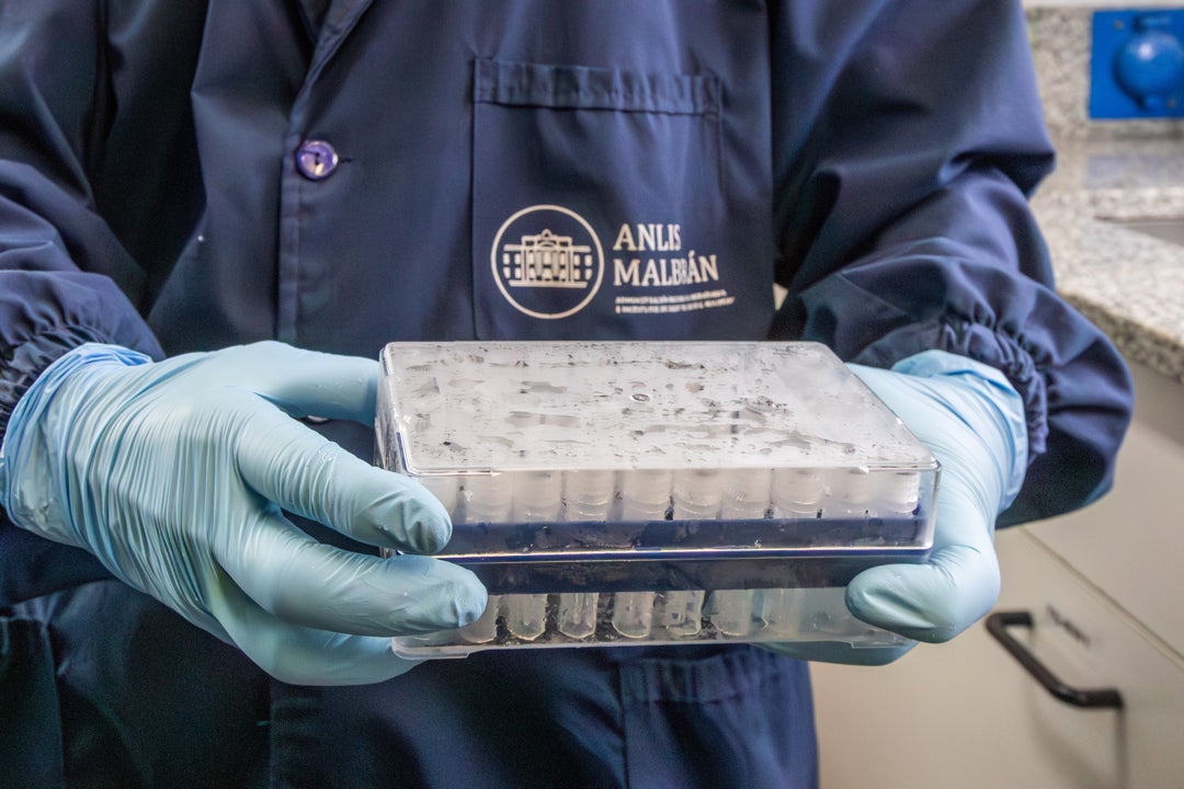 Fotografía cedida por ANLIS Malbrán que muestra a una persona sosteniendo una bandeja con tubos de laboratorio en Buenos Aires (Argentina). Fotografía cedida por ANLIS Malbrán que muestra a una persona sosteniendo una bandeja con tubos de laboratorio en Buenos Aires (Argentina).