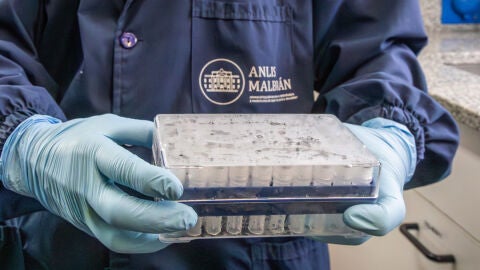 Fotografía cedida por ANLIS Malbrán que muestra a una persona sosteniendo una bandeja con tubos de laboratorio en Buenos Aires (Argentina). EFE/ ANLIS Malbrán Fotografía cedida por ANLIS Malbrán que muestra a una persona sosteniendo una bandeja con tubos de laboratorio en Buenos Aires (Argentina). EFE/ ANLIS Malbrán