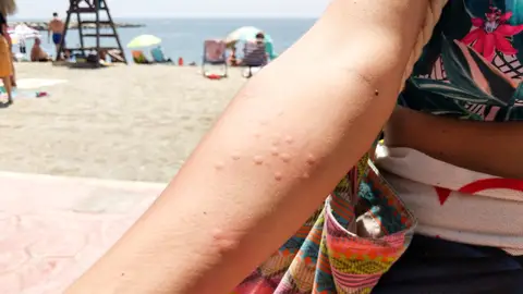 Los especialistas de Vithas Castellón explican cuándo acudir a urgencias y cómo actuar con las picaduras de medusas Los especialistas de Vithas Castellón explican cuándo acudir a urgencias y cómo actuar con las picaduras de medusas
