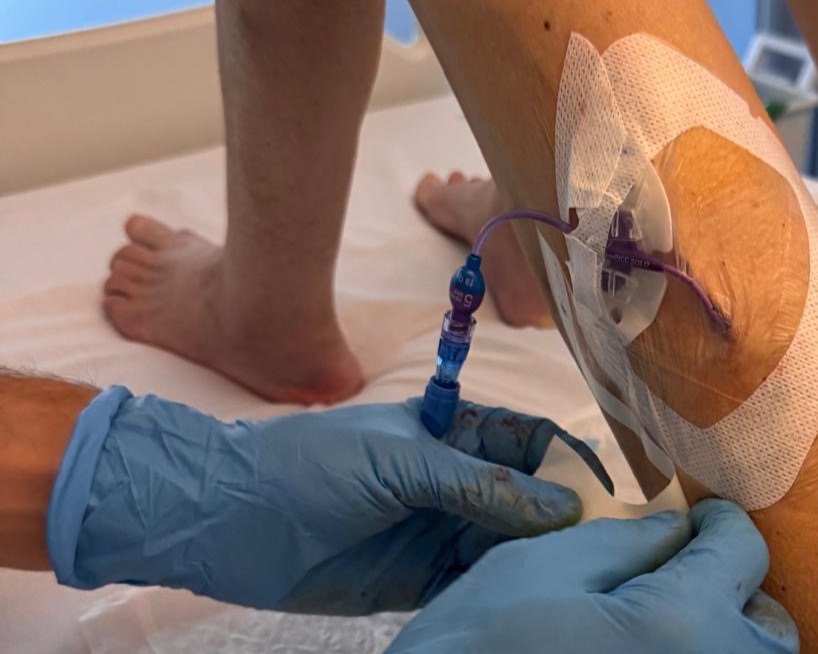 El Hospital General de Elda amplía las opciones terapéuticas para pacientes con accesos venosos difíciles El Hospital General de Elda amplía las opciones terapéuticas para pacientes con accesos venosos difíciles