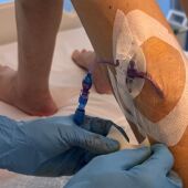 Implantación de un catéter femoral central de inserción periférica mediante técnica ecoguiada.