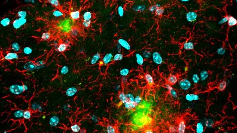 Imagen del cerebro de un ratón modelo de enfermedad de Alzheimer. Imagen del cerebro de un ratón modelo de enfermedad de Alzheimer.