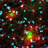 Imagen del cerebro de un ratón modelo de enfermedad de Alzheimer. 
