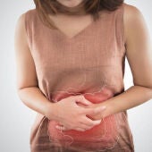 Los expertos alertan que las altas temperaturas elevan el riesgo de intoxicaciones alimentarias este verano