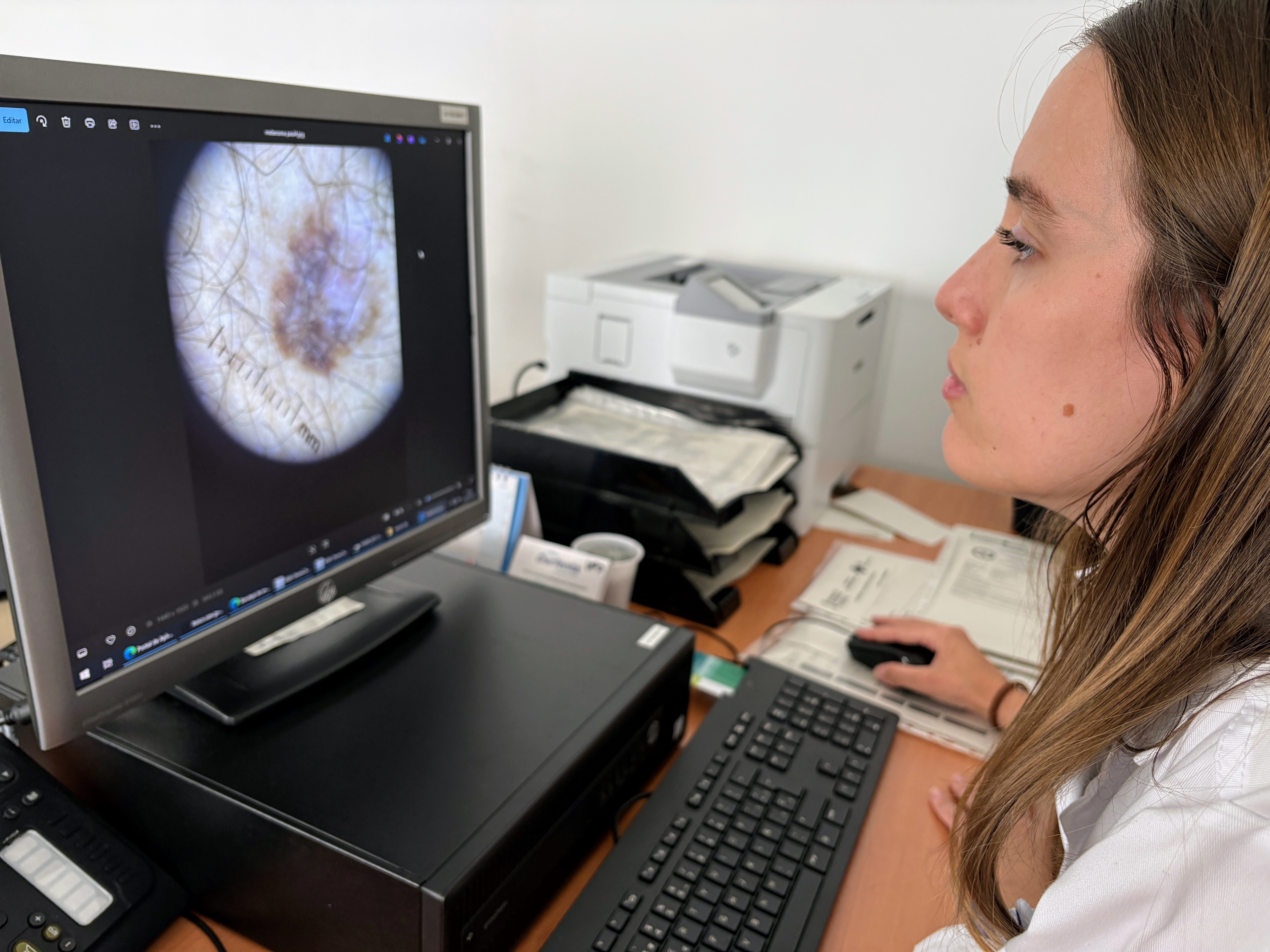 El Departamento de Salud de Orihuela refuerza Teledermatología y adquiere dermatoscopios para sus centros de salud El Departamento de Salud de Orihuela refuerza Teledermatología y adquiere dermatoscopios para sus centros de salud