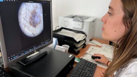 El Departamento de Salud de Orihuela refuerza la Teledermatolog&iacute;a con la adquisici&oacute;n de dermatoscopios en sus centros de salud 