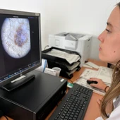 El Departamento de Salud de Orihuela refuerza la Teledermatología con la adquisición de dermatoscopios en sus centros de salud El Departamento de Salud de Orihuela refuerza la Teledermatología con la adquisición de dermatoscopios en sus centros de salud