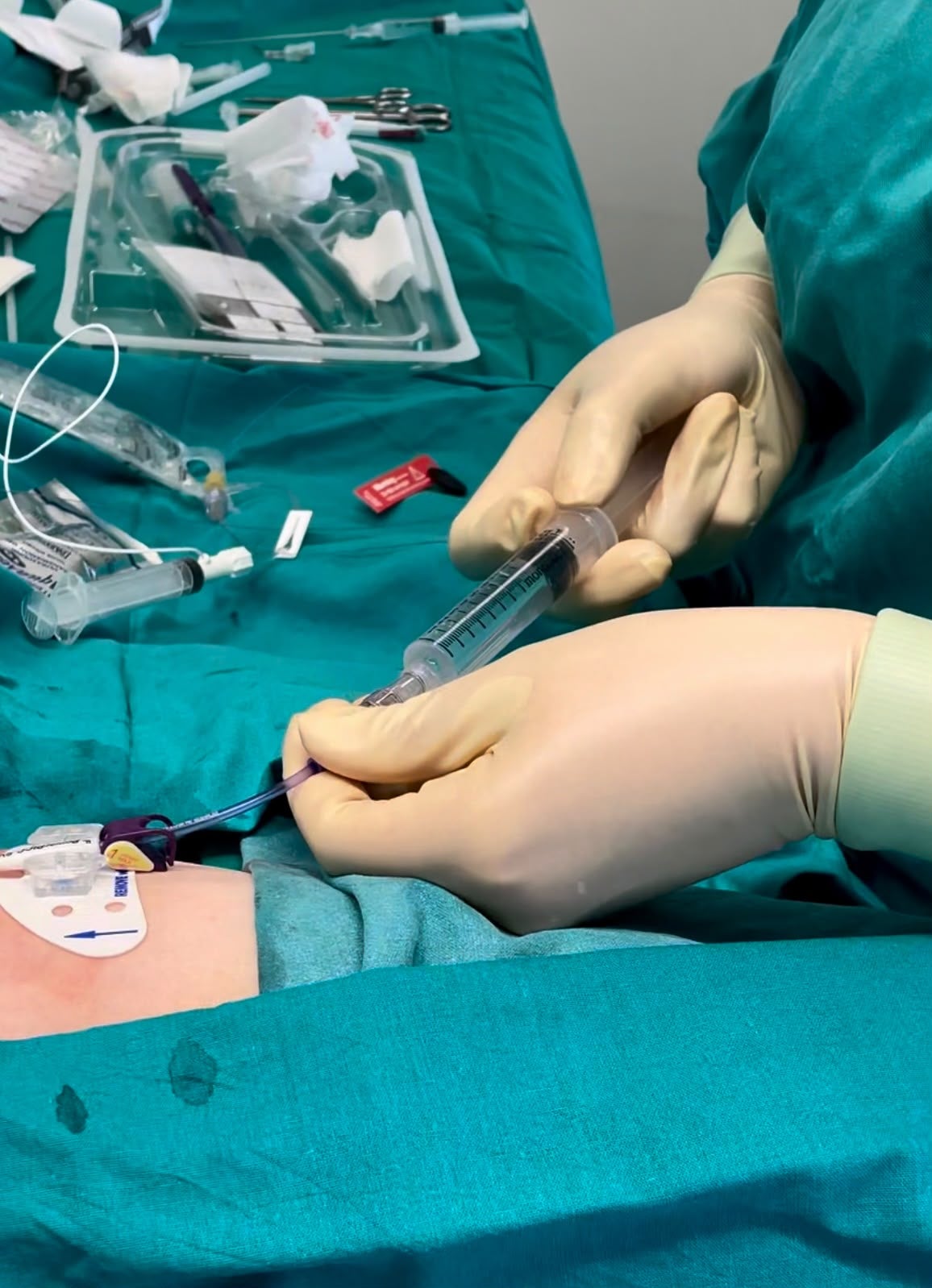 El Hospital General de Elche crea un equipo para mejorar el acceso vascular de pacientes hospitalizados y ambulatorios El Hospital General de Elche crea un equipo para mejorar el acceso vascular de pacientes hospitalizados y ambulatorios