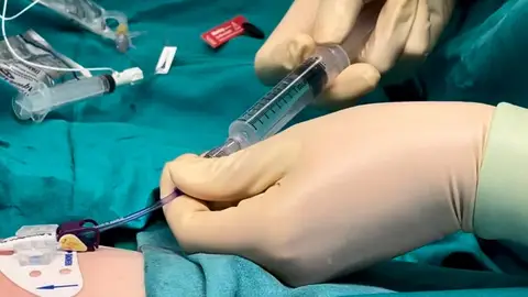 El Hospital General de Elche crea un equipo para mejorar el acceso vascular de pacientes hospitalizados y ambulatorios. El Hospital General de Elche crea un equipo para mejorar el acceso vascular de pacientes hospitalizados y ambulatorios.
